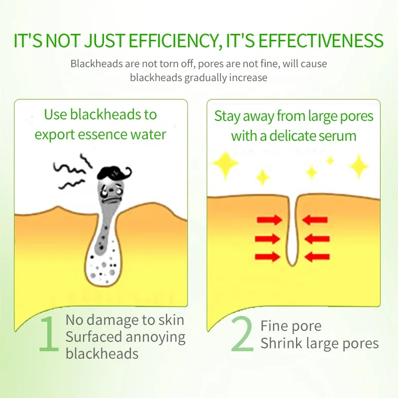 BISUTANG Herbal Formulas Blackhead Removal Face Serum Kit Shrink Purifying Pores Minimizer Blackhead Remover Serum Set