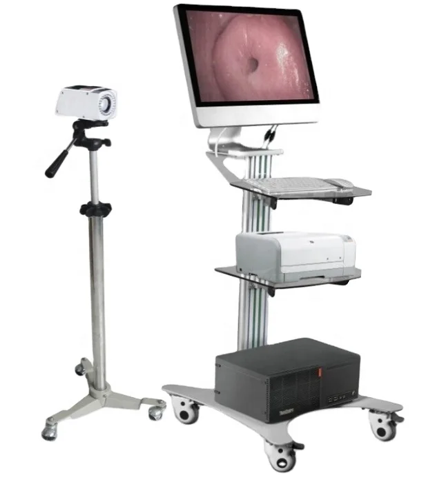Digital Colposcope Imaging System Vagina Examination Colposcope for Gynecology Digital Colposcope video