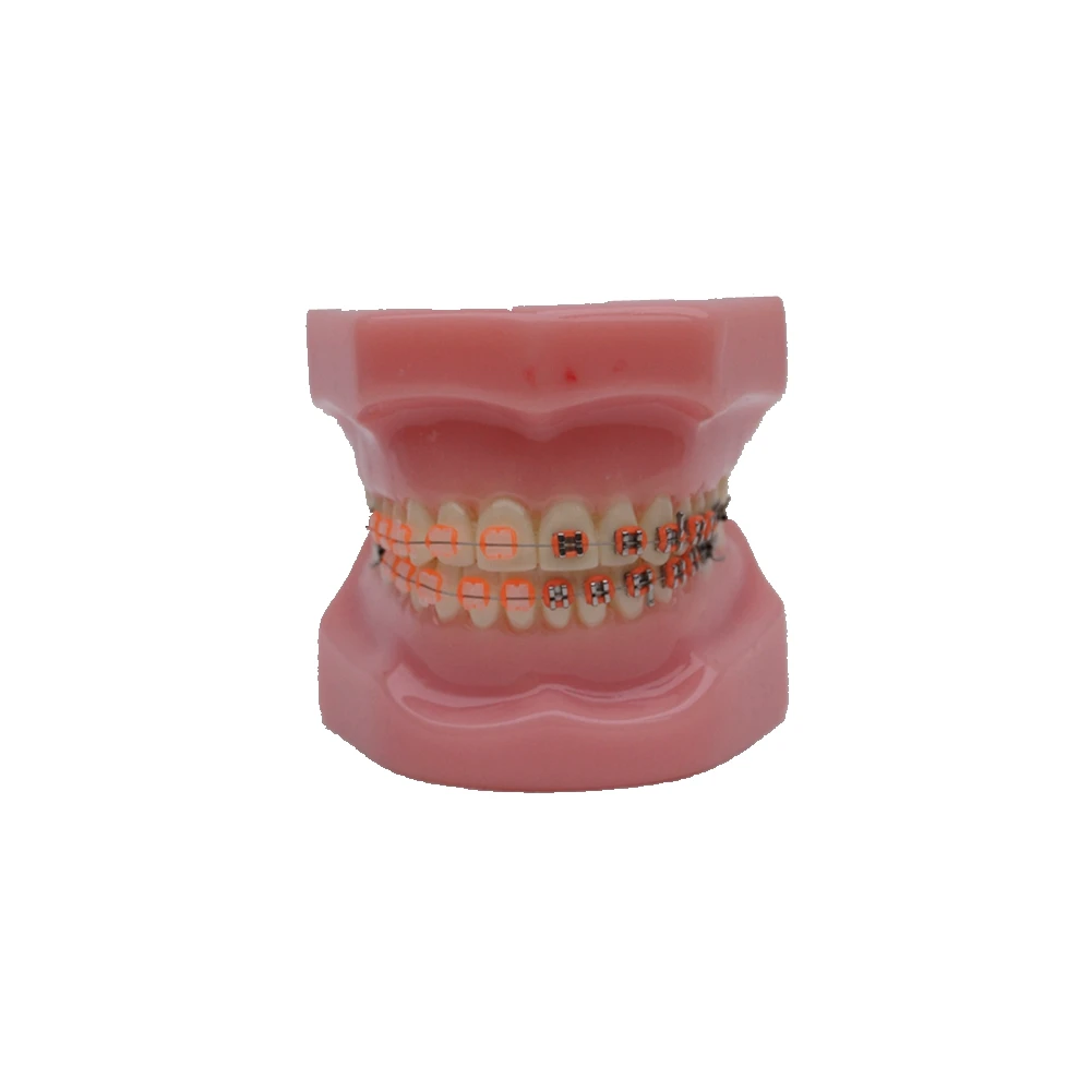 Стоматологическая Ортодонтическая модель с металлическим и керамическим кронштейном