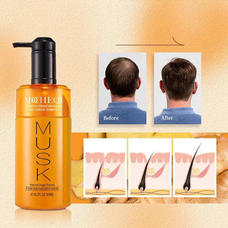 MOCHEQI OEM hair growth treatment hair care set biotin ginger shampoo custom hair growth shampoo and conditioner set