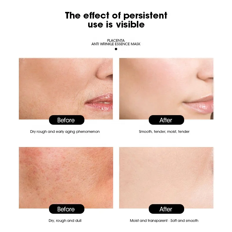 MULAN Placenta anti wrinkle essence mask Anti Aging Hydrating Facial Mask Retinol Collagen MaskEssence Face Mask Paper