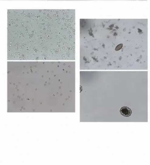 Двухканальный автоматизированный анализатор фекалий/анализы банки Фекалий