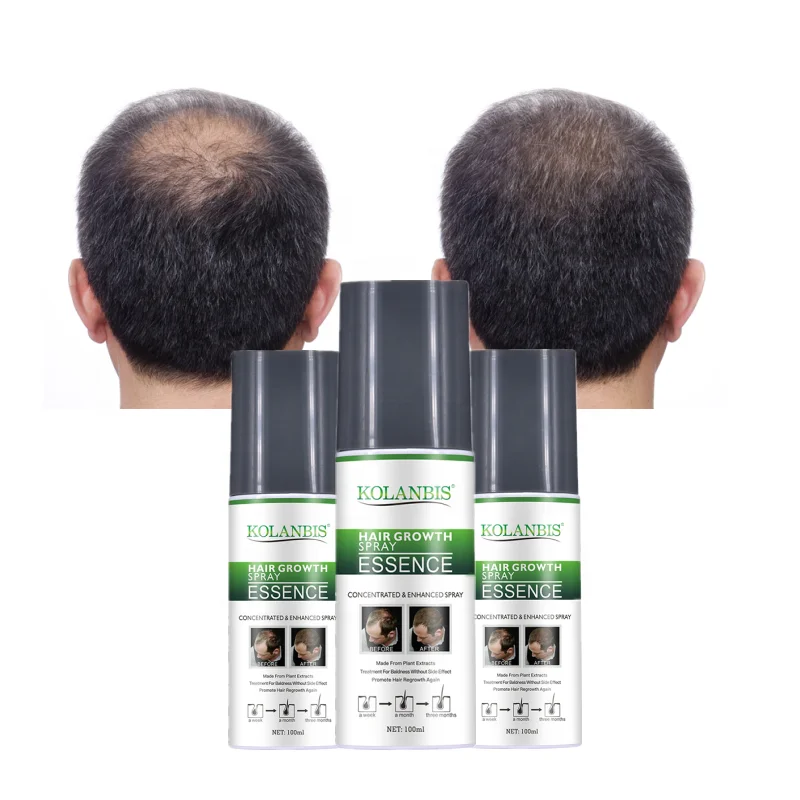 Anti Loss Products Serum Oil For Hair Growth Stimulate Hair Follicle No Side Effect 100ml