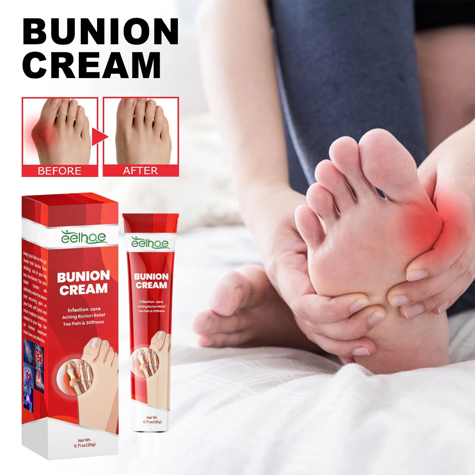 EELHOE High Quality Vegan Ingredients Infection Care Aching Bunion Relief Toe Pain Stiffness Bunion Cream