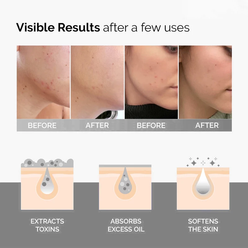 Men women oily skin pore minimizer deep cleansing face skin care and body mask dead sea mud mask