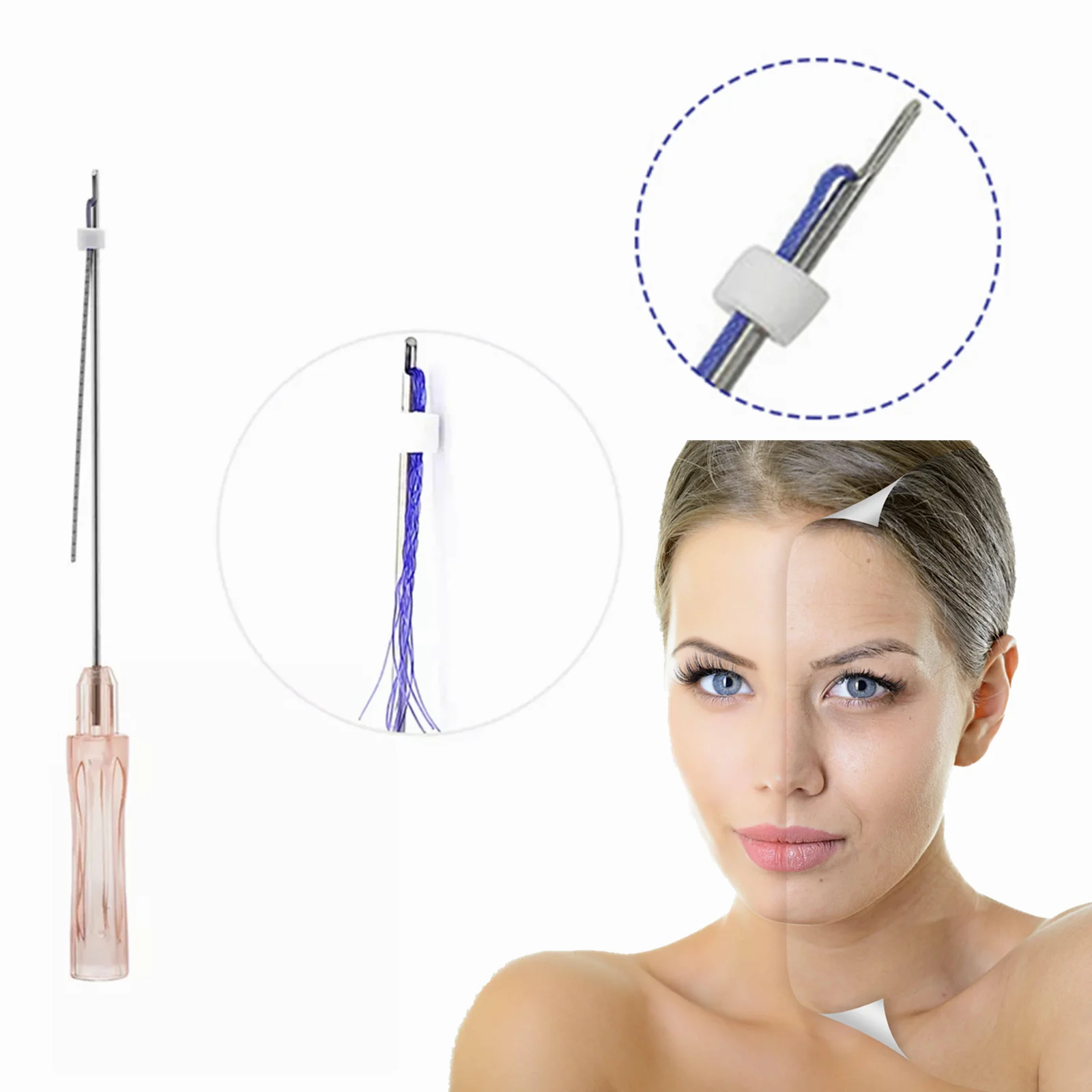 wholesale factory price high quality pdo mesh thread for face lifting