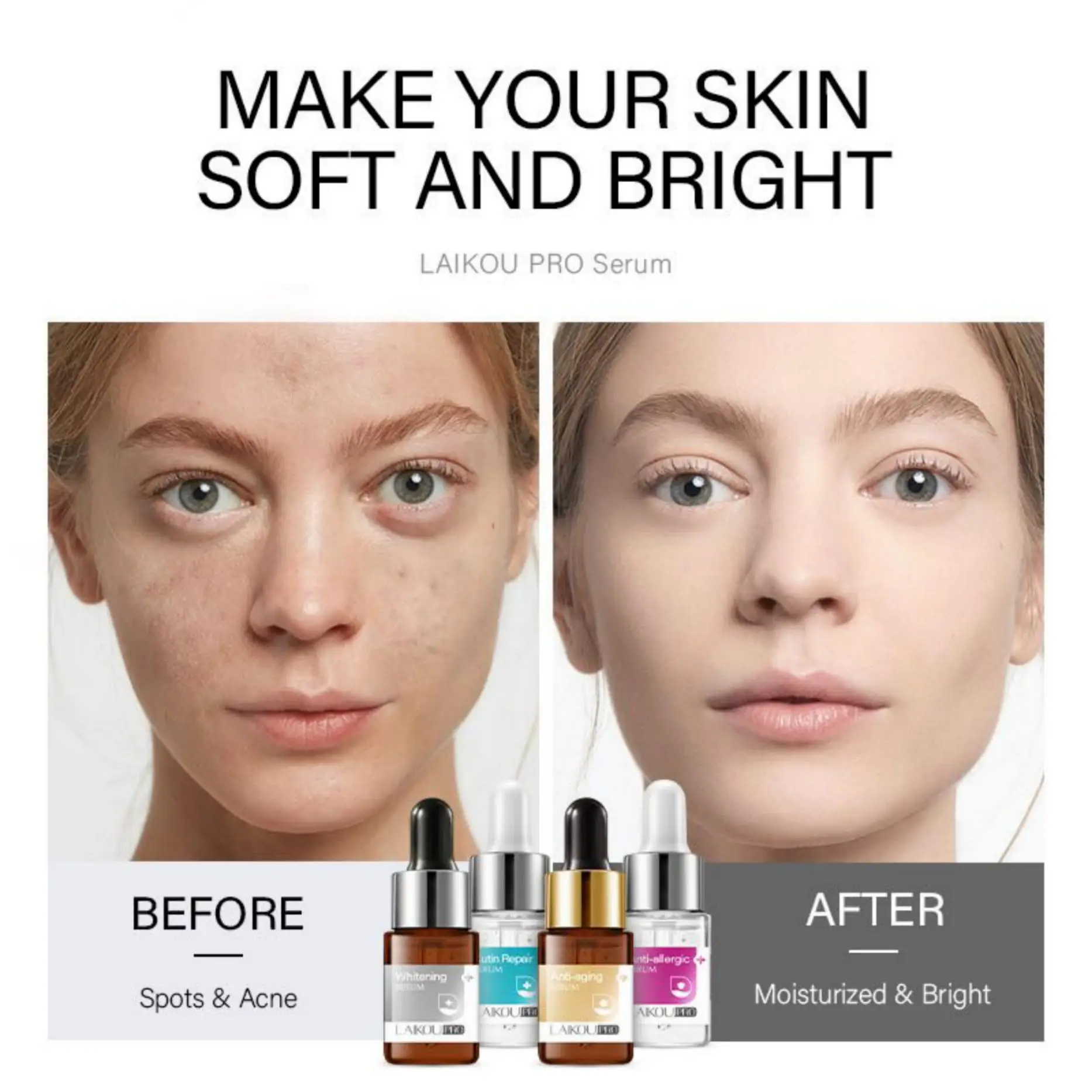 LAIKOU Essence Lotion Moisturizing and Anti Wrinkle Skin Care Product Hyaluronic Acid Four Color Liquid Vitamin C Face Female