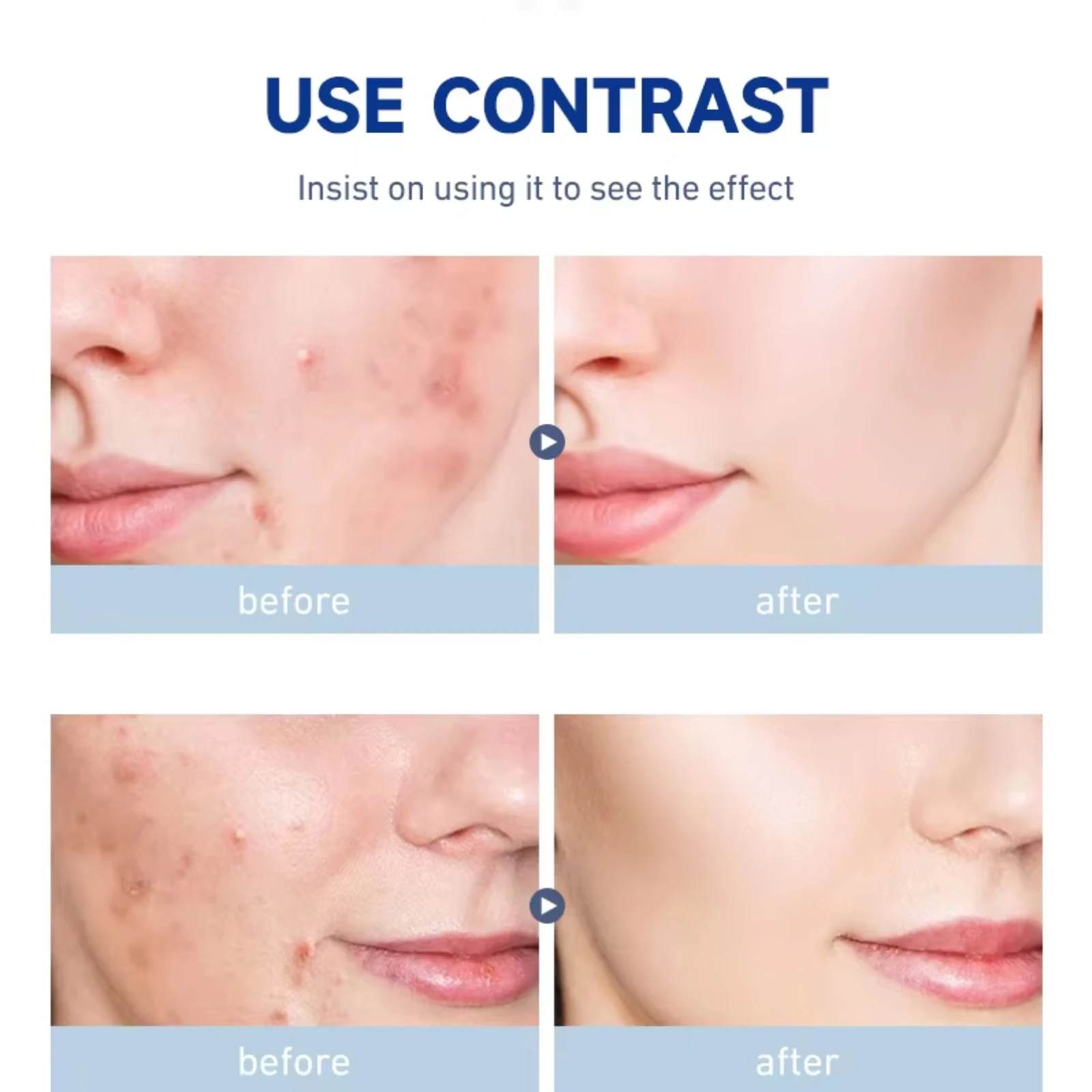 Private Label Natural Sun Protection Skin Moisturizer Whitening Anti Aging Kojic Acid Face Cream For Women
