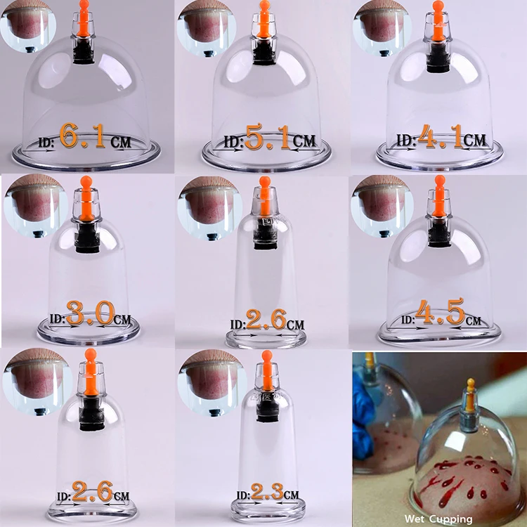 2000 MIX cupping cups wholesale Disposable ventosas suction hijama suction cup tasse ventouses plastic vaccum cupping with pump