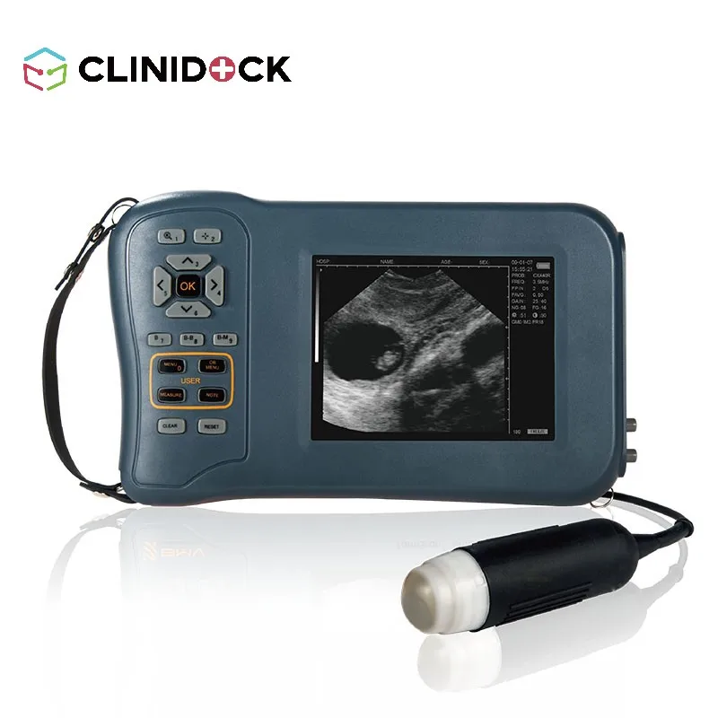 Digital Veterinary Ultrasound Diagnostic System