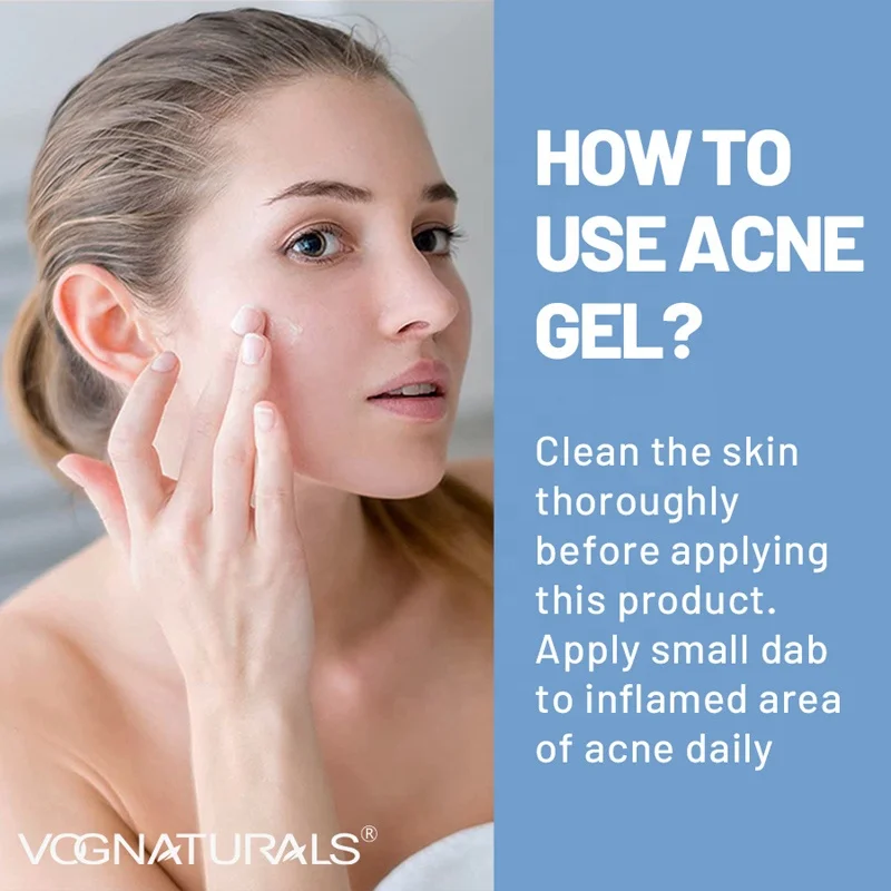 OEM Private Label Probiotic  Soothing Reduces Redness Prevent Breakouts Anti-inflammatory Acne Remover Gel