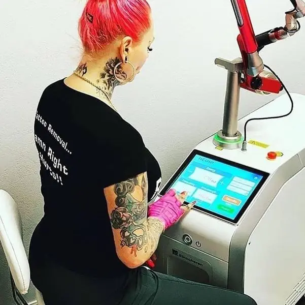 2023 q switched nd yag laser tattoo removal machine q switch laser with South Korea imported light guide arm