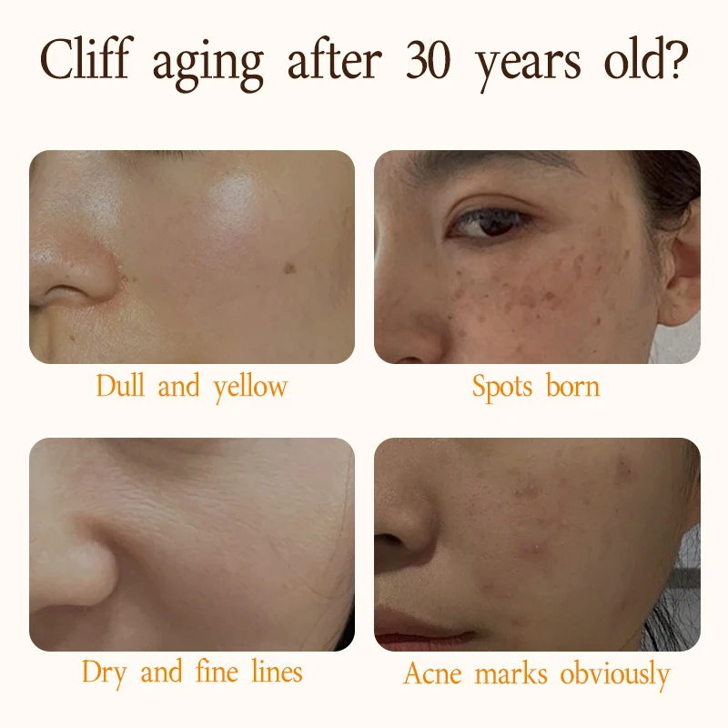 Best Sales 30ml Private Label Organic Face Skin Care Serum Moisturizing 377 Whitening Pale Spots Essence