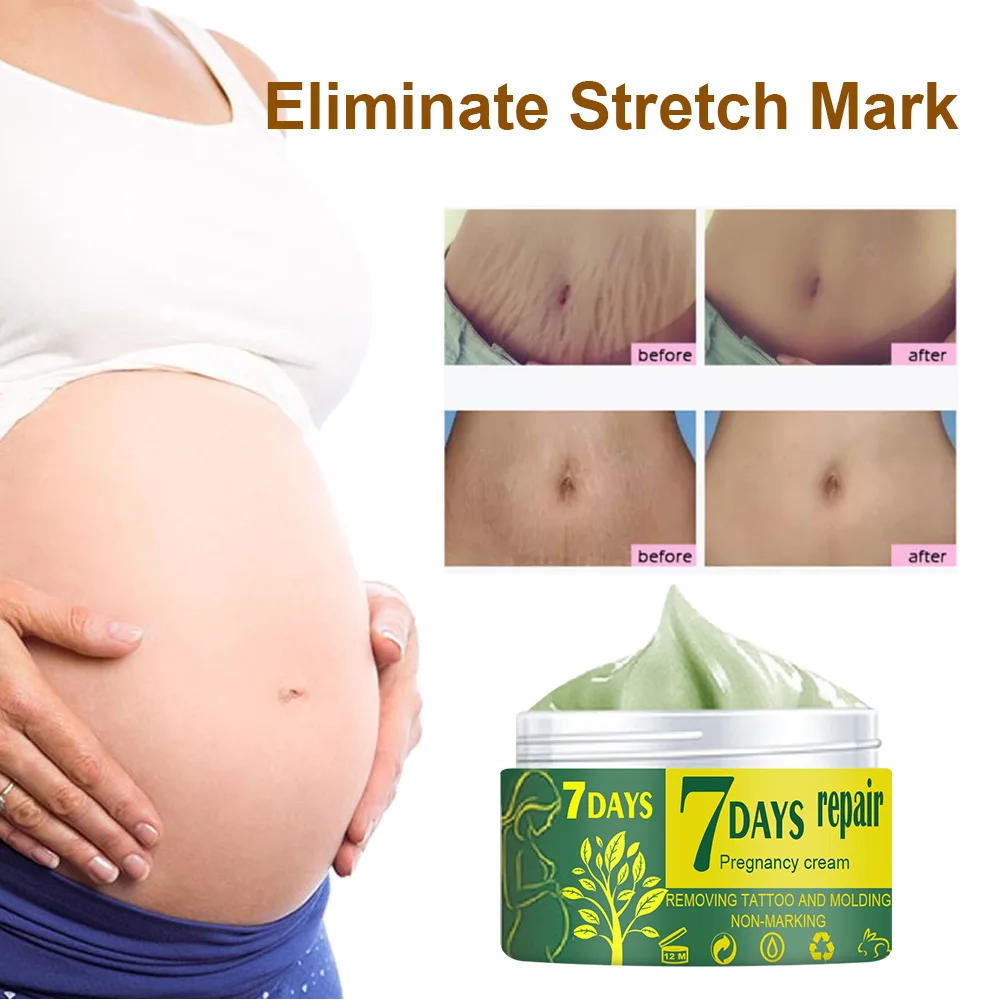 Natural Mild Non-irritating Remove Stretch Mark Cream for Pregnancy Repair Scar Slack Line Abdomen Stretch Marks Cream