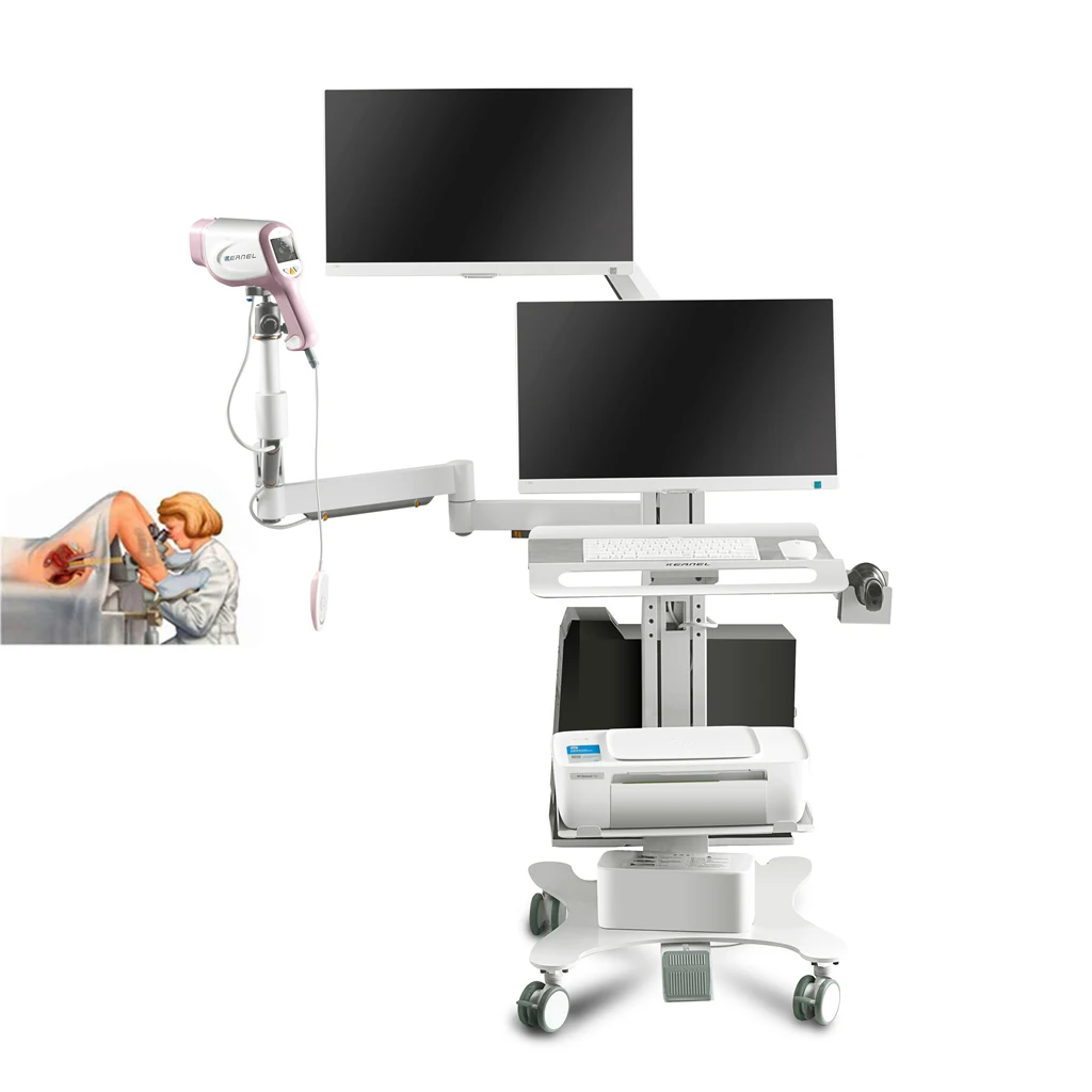 Colposcope Portable Medical Device Colposcope-Digital Lc-9100c Video Colposcopy Machine for Colposcopio Digital