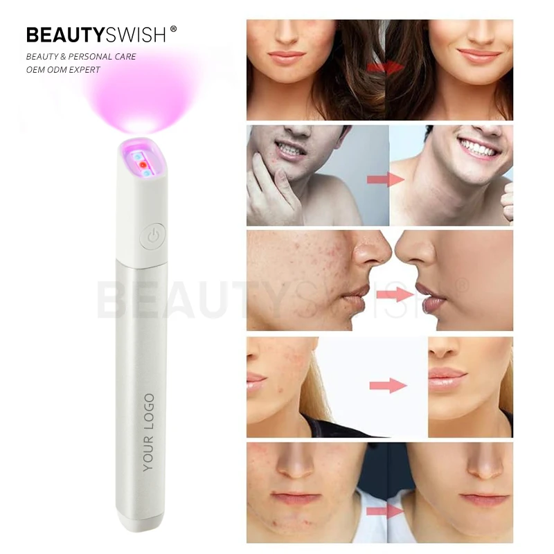 High Quality Removing Acne Removing Pen Beauty Removing Spots Removing Moles Pen With Blue And Red Light