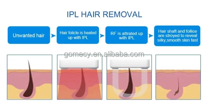 Beauty-Laser-Machine-Aesthetic