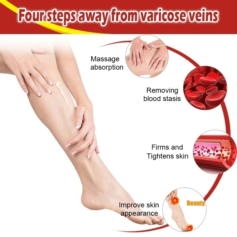 OEM Genital Scrotum Varicocele Varicose Veins Cream Varicosity Angiitis Phlebitis Leg Veins Pain Ointment