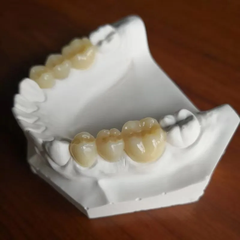 2019 New Sale Cad Cam System Milling Machine Zirconia JD-N4 4 axis Denture Crown Equipment