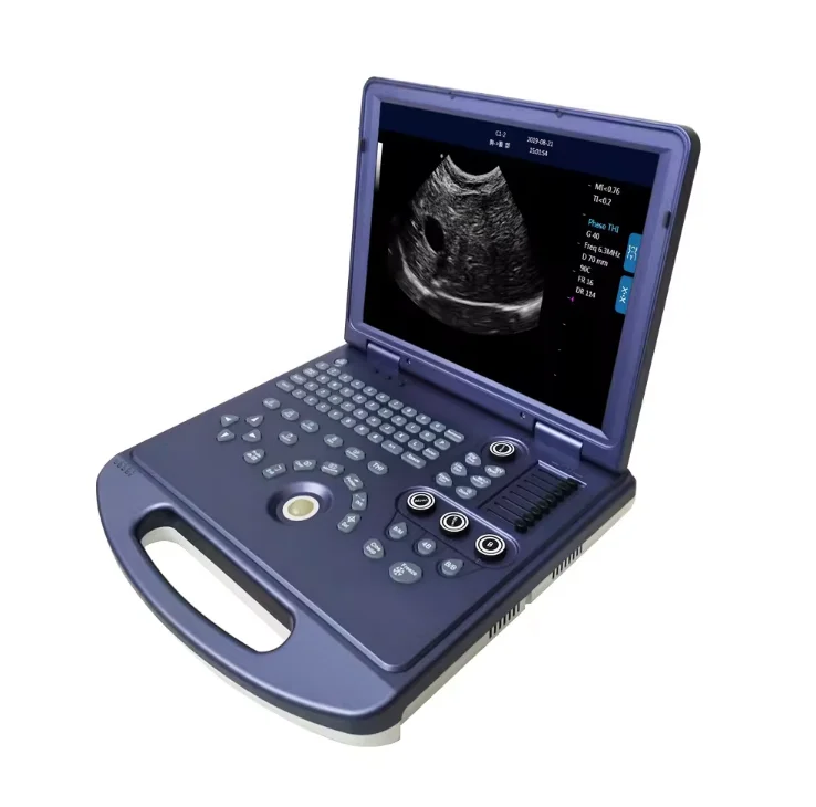 15-дюймовый цветной ЖК-дисплей/жесткий диск 128 г/цифровая ветеринарная медицинская система dawei dw MU15 Ультразвуковое медицинское оборудование