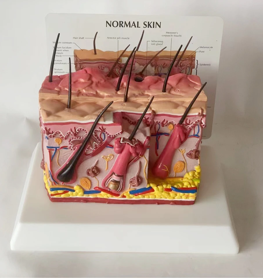 Medical science  biology  pathological skin acne anatomical  structure 3D diseased  model