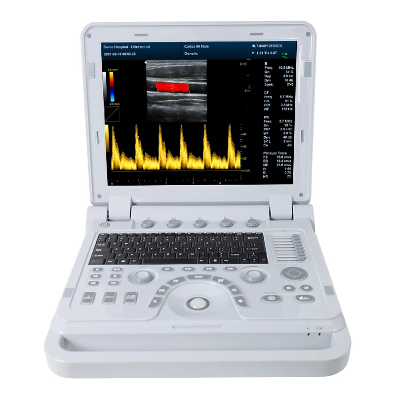 Ультразвуковое оборудование CONTEC CMS1700B doppler портативный 3D 4D