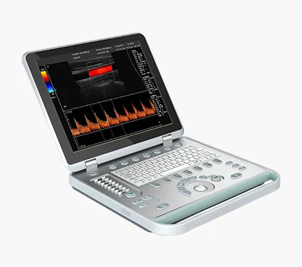 Цветной доплеровский ультразвуковой аппарат для ноутбука по низкой цене