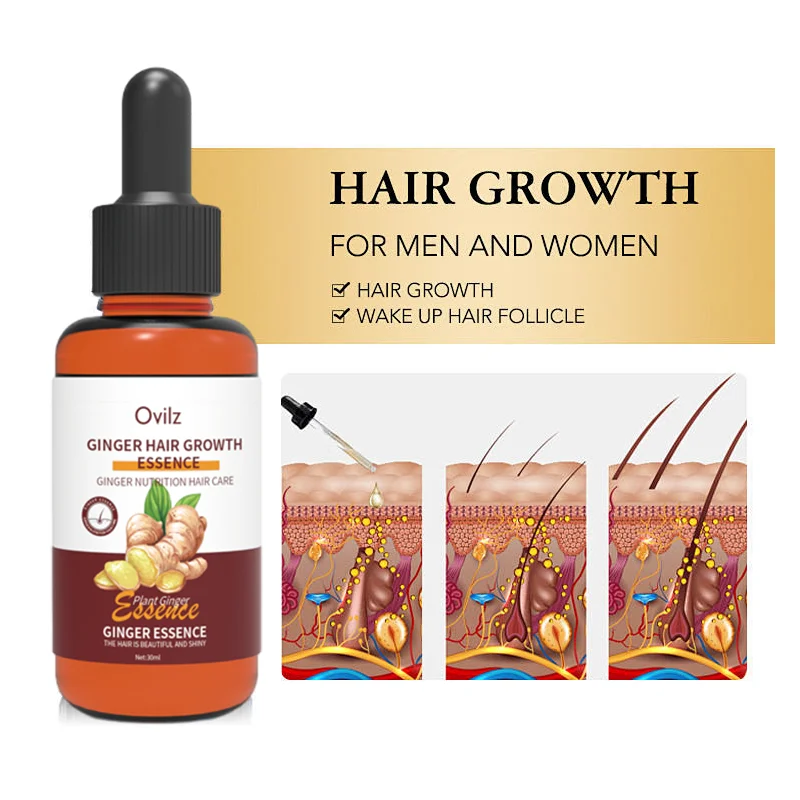 OVILZ Organic Ginger Hair Growth Oil Serum Keratin Herbal Infused Hair Regrowth Care Serum for women