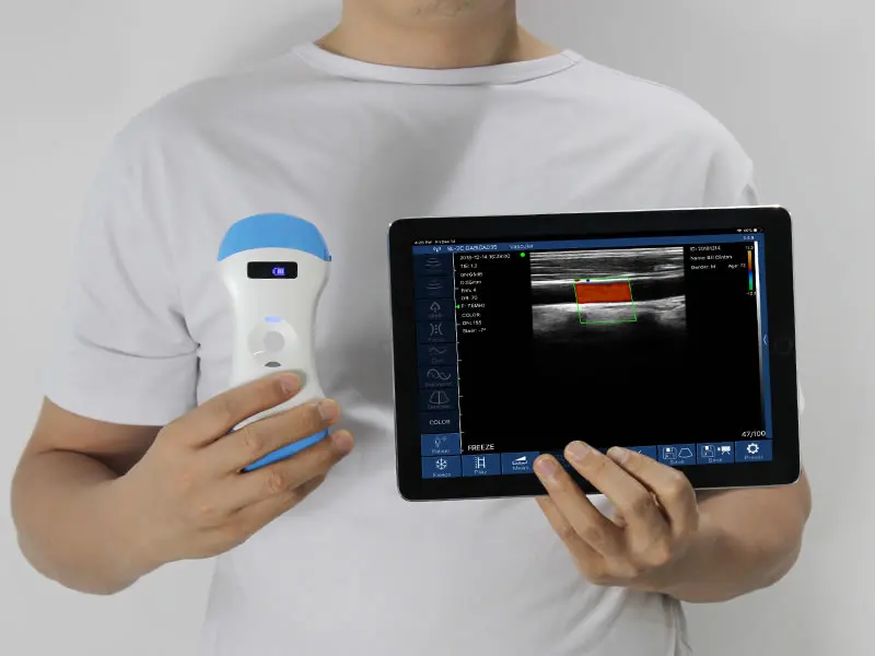 Suresult Eagle View Portable And Sonostar Uprobe C4PL Wireless Ultrasound Scanner Available On Global Digital Export Platform