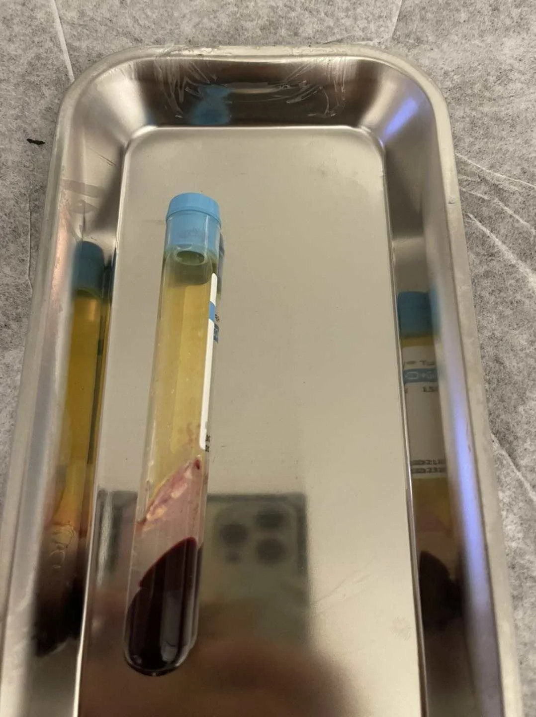 Hot Sell Cosmetic Clinical 12ml Blue Blood PRP Tube Sodium Citrate Gel PRP Injection for Face v Lifting Skin Care Knee joint