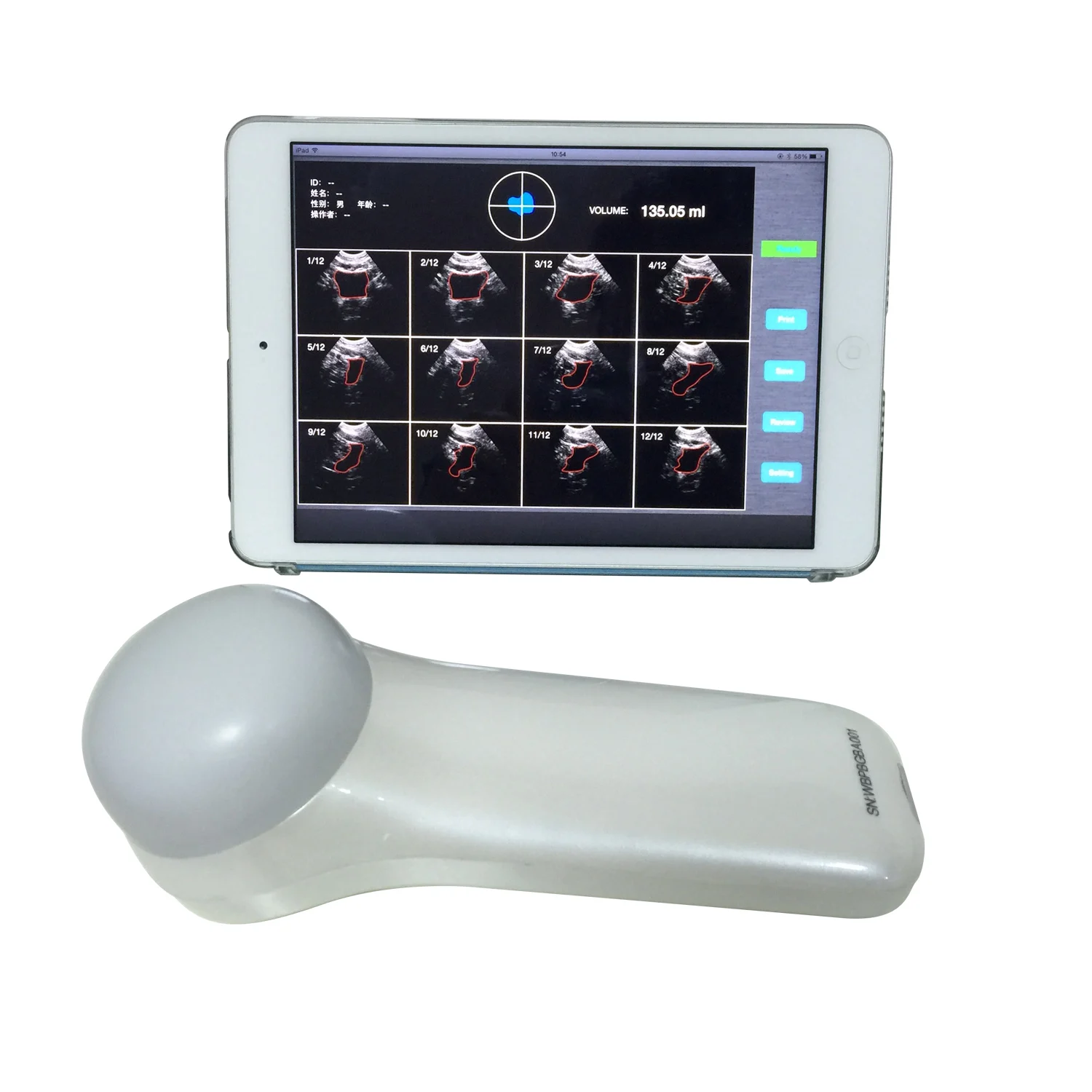128 Elements Wifi USG Wireless Ultrasound Probe Portable Ultrasound 4D Wireless Bladder Scanner