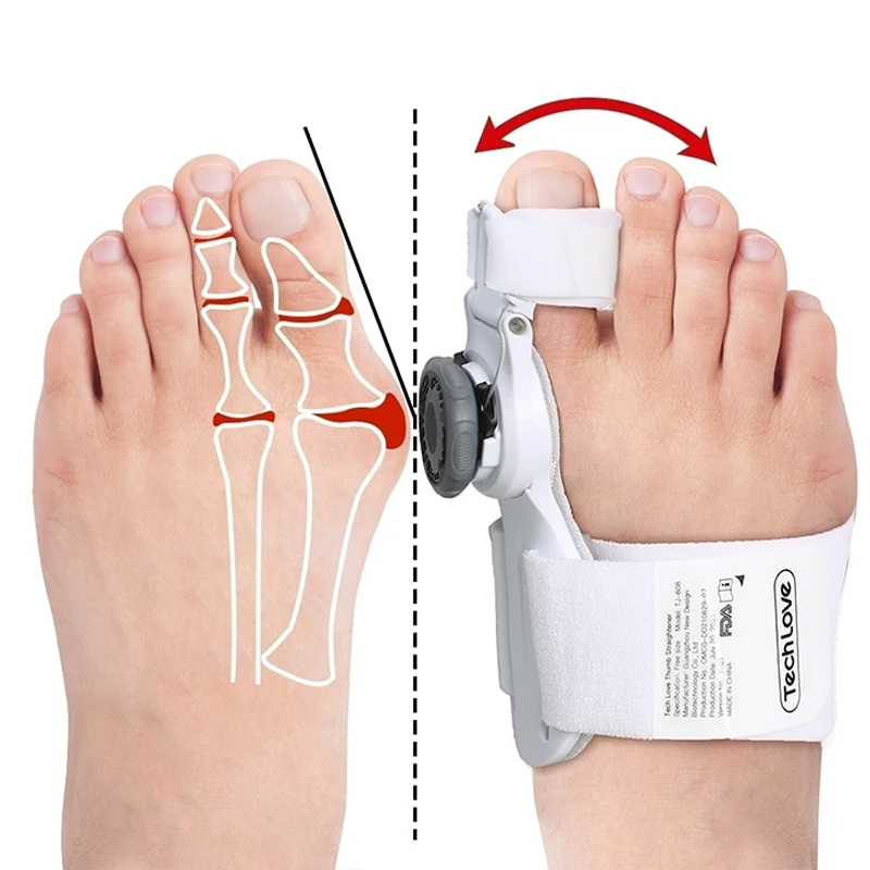 orthopedic bunion pedi toe spacers orthopedic corrector for the feet