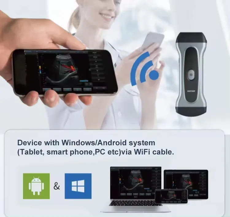 USB Wireless wifi Mini Handheld Scanner Pet Animal Monitor Probe Portable Vet Ultrasound Machine for Veterinary Use