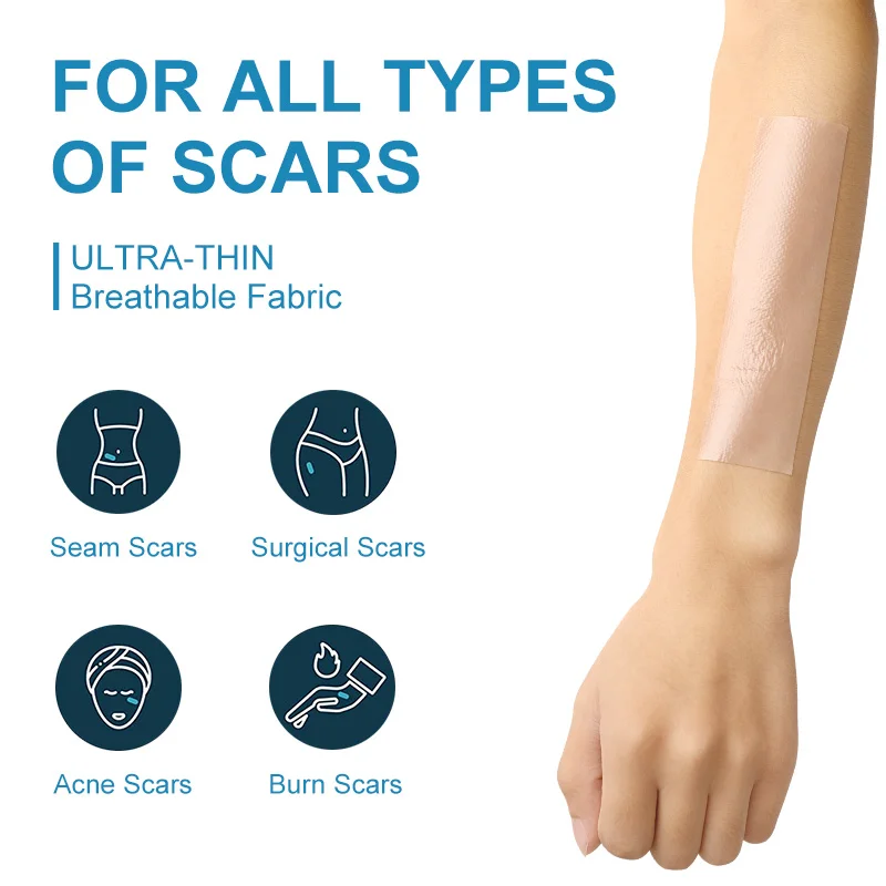 Silicone scar Patch Waterproof Medical scar treatment Skin repair Silicone scar removal sheet