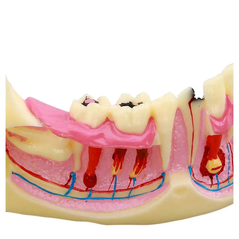 Gelsonlab HSDT-N14 Dental Decomposition Model Organization od Mandible Model