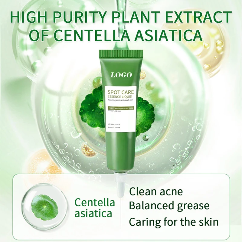 Deep clean dirt and acne Clean pores improve stains Moisturize skin anti acne face cream acne removal korean