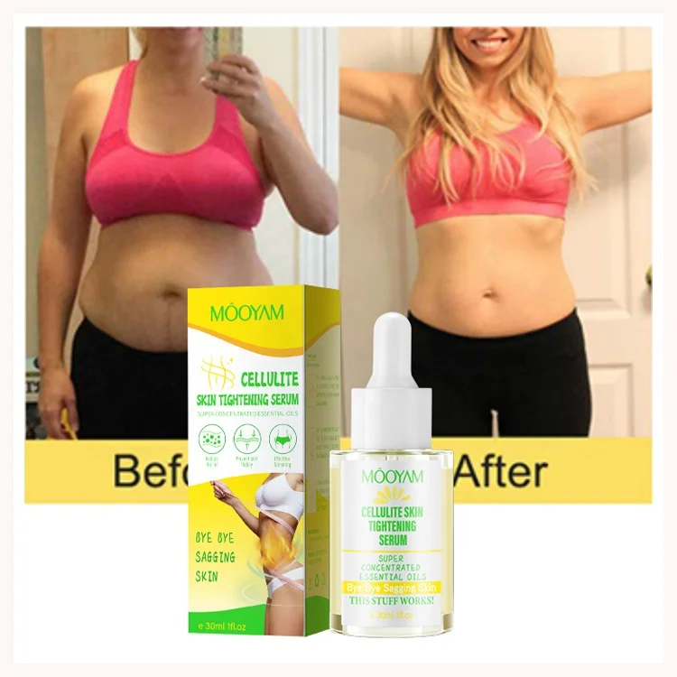 Private Label Cellulite Skin Tightening Serum Weight Loss Firming Anti Cellulite Liposuction Body Serum