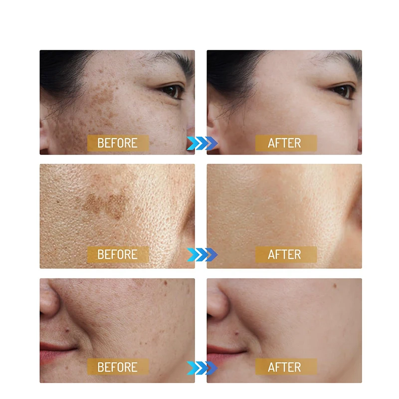 Best Sales 30ml Private Label Organic Face Skin Care Serum Moisturizing 377 Whitening Pale Spots Essence