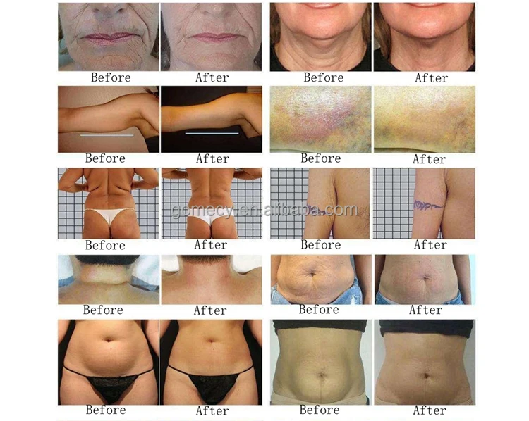 Rotary RF Slim 1 (7).jpg