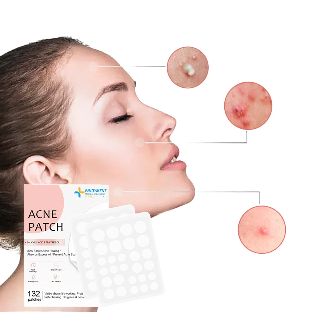 In stock 144 Pcs Acne Pimple Master Patch Waterproof Pimple Patch Hydrocolloid Acne Patch