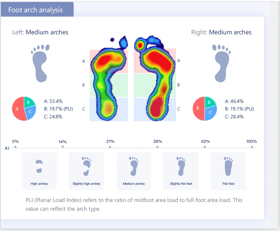 Foot arch analysis.png