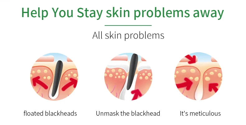 Customized Private Label Blackhead Remove Nose Strip Skin Care Deep Cleansing Shrink Pores Pore Clean Nose Strips