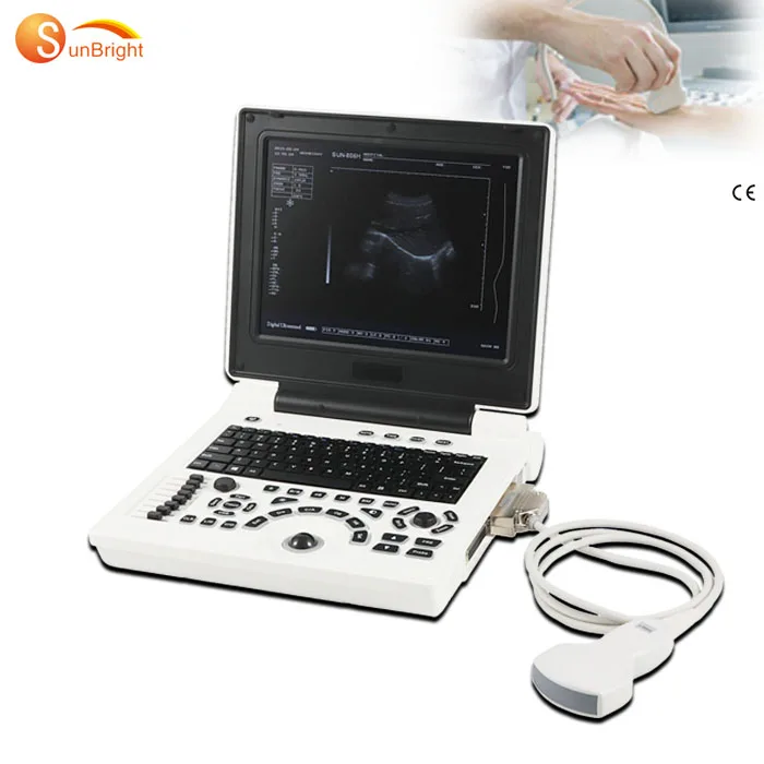 Portable laptop type obstetric vascular medical ultrasonic system economical ultrasound machine