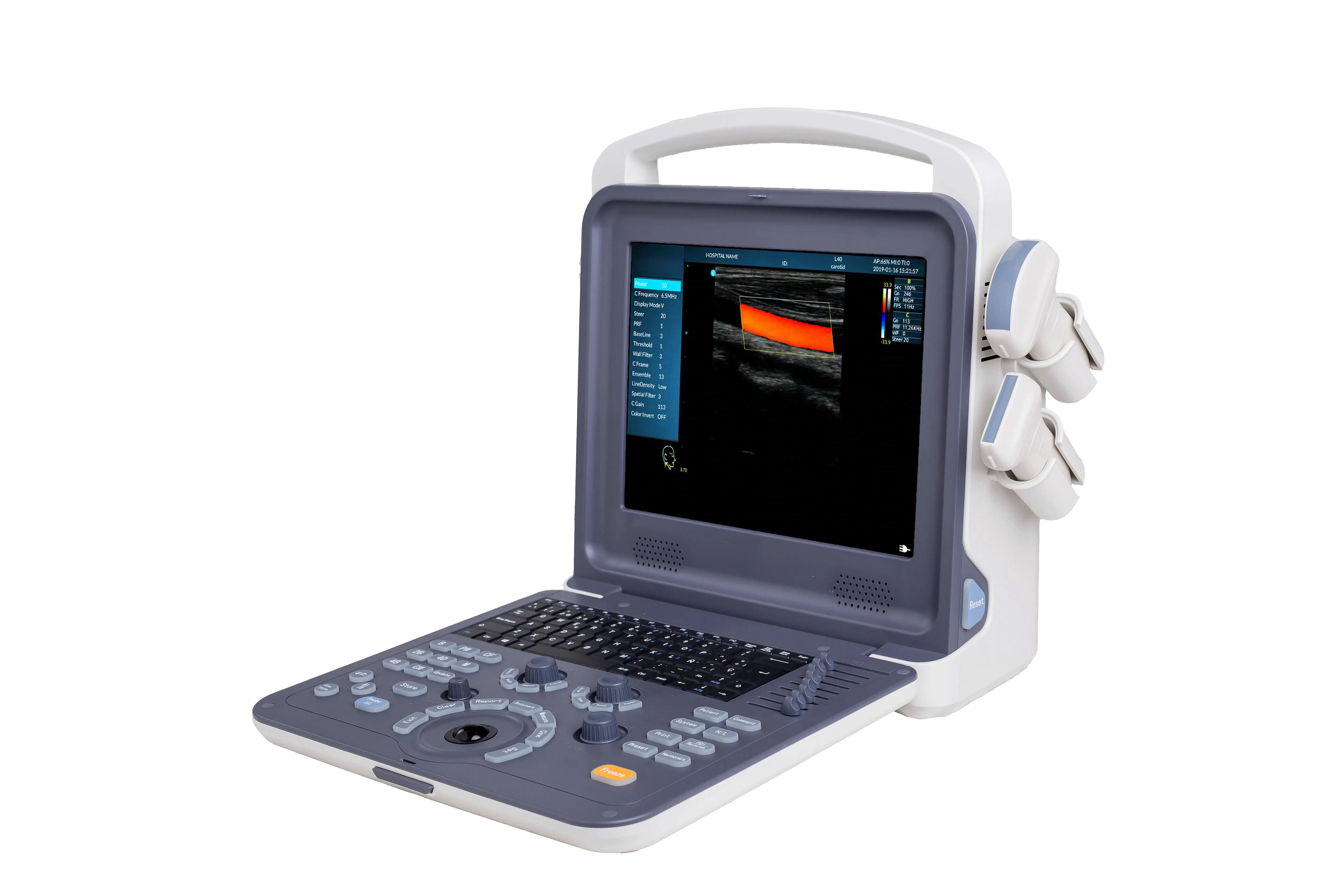 Amain Factory Wholesale Price Portable Ultrasound Color Doppler Ultrasound Scanner For Vet & Human