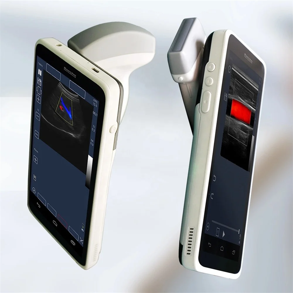
1280*720 High Resolution Pocket Color Ultrasound Device Mini Handheld WIFI Ultrasound USB Probe 
