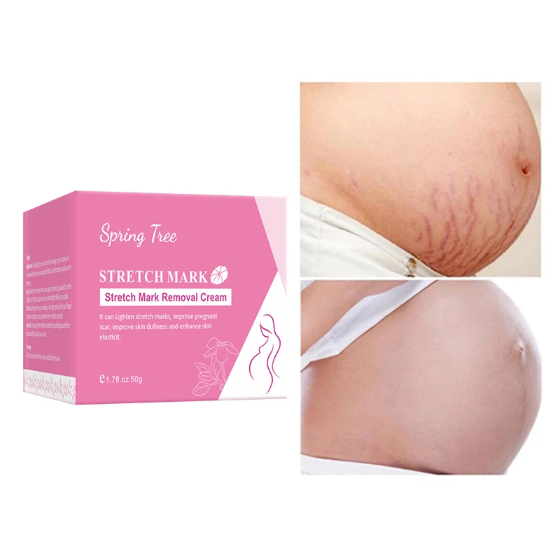 Private label stretch mark cream Eliminate stretch marks in one week Natural and organic asiaticoside stretch mark cream