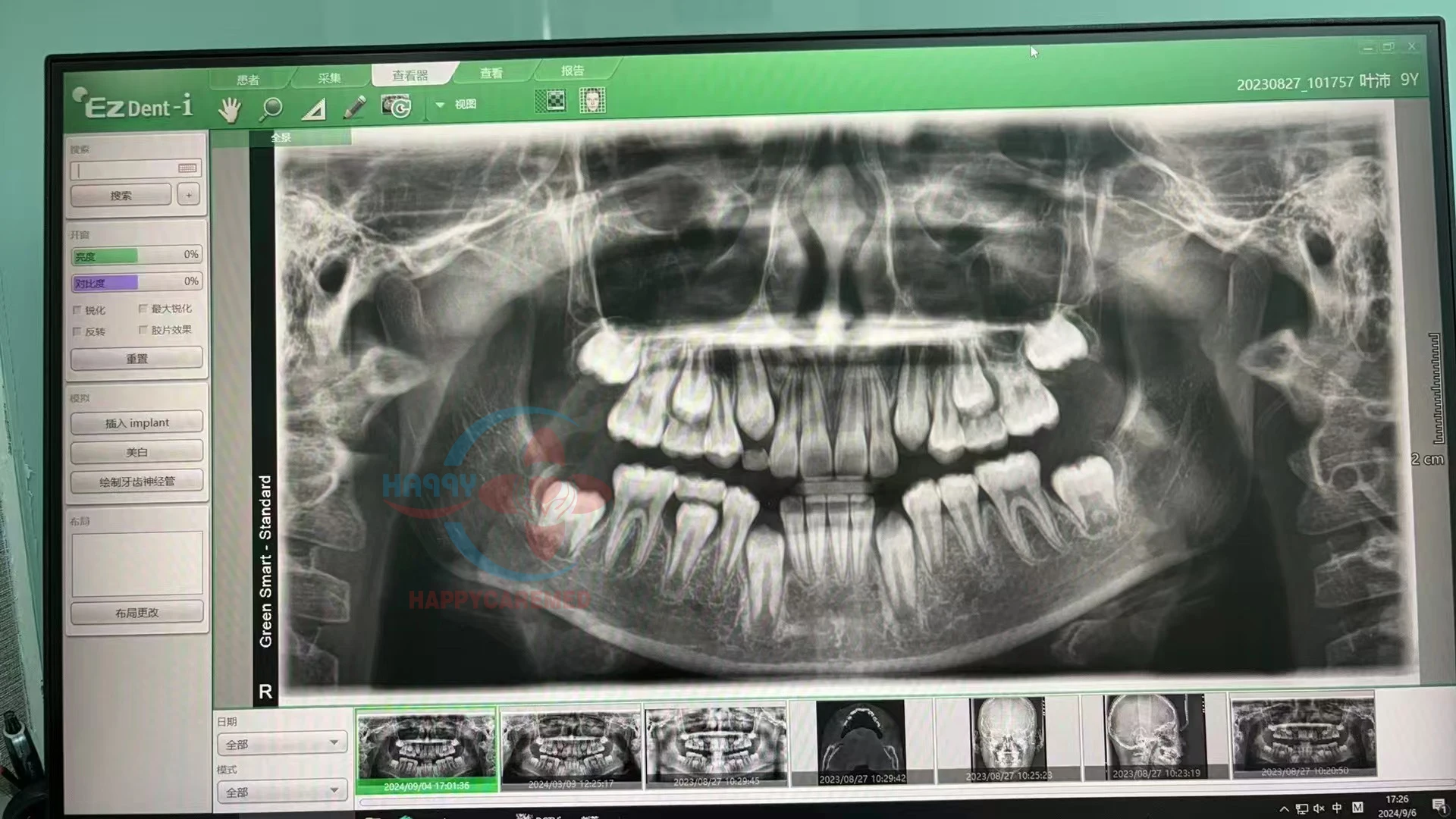 Стоматологический рентгеновский аппарат cbct стоматологический opg PHT-35LHS поля зрения 12*9 см высокочастотный