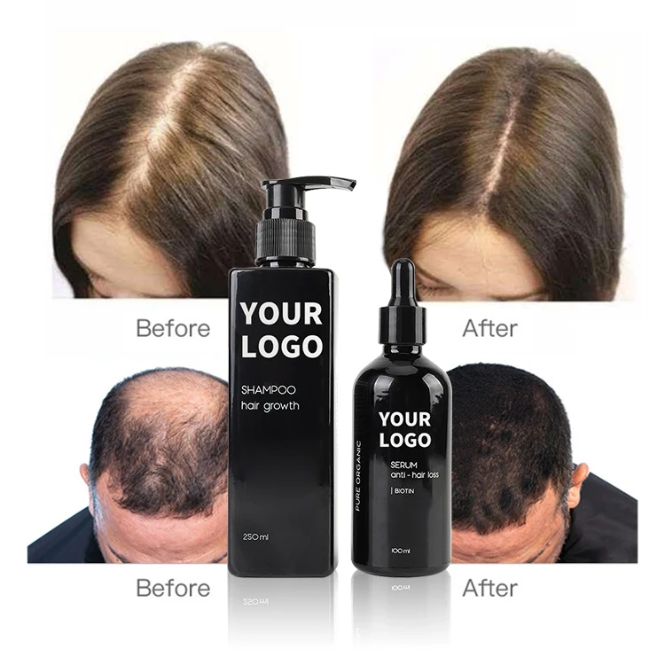 Hair Growth Serum Private Label Organic Scalp Care Repair Regrowth Anti- Loss Ginseng Ginger Regrowth Serum Hair Treatment Oil