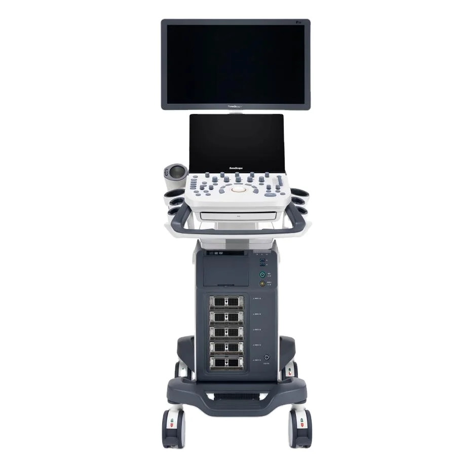 SonoScape  A5 Ultrasound /Ultrasound Diagnosis Digital Color Doppler Ultrasound Machine Price