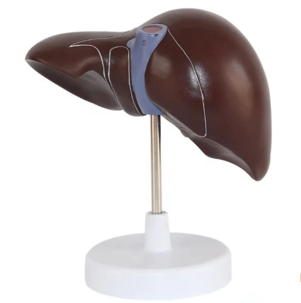 Medical Supplies Human Teaching Liver Pathological Model For School Medical Teaching Display Tool Lab Equipment